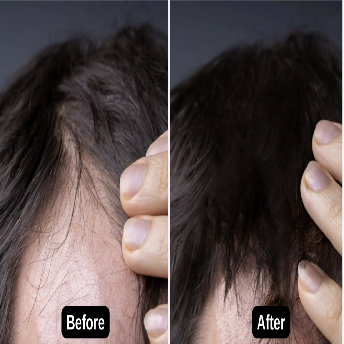 Organic Hair Growth Oil